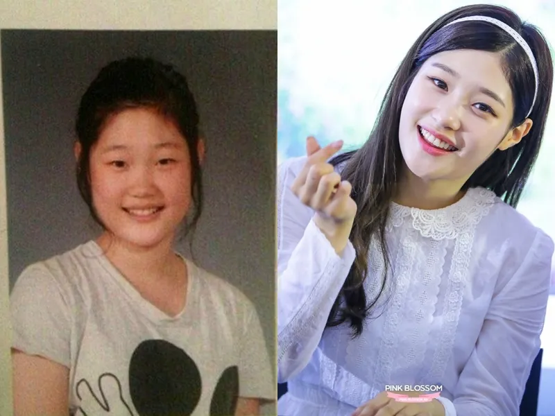 Chaeyeon DIA