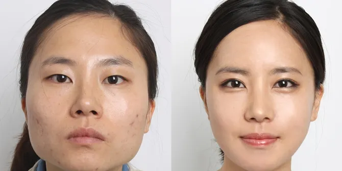 Ilustrasi operasi di Korea Selatan © Business Insider