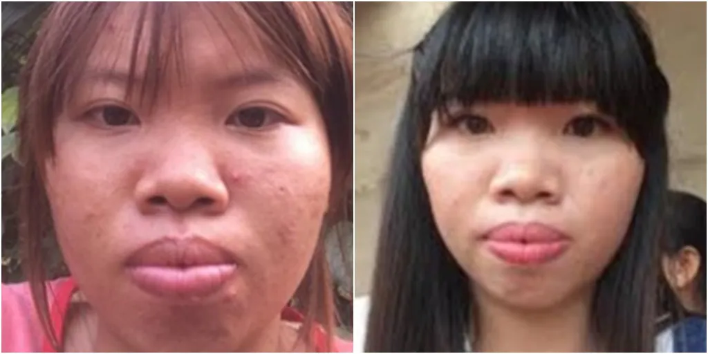 Kuok, gadis Vietnam berusia 22 tahun yang diejek temannya karena memiliki bibir tebal dan hidung tak begitu mancung © world of buzz