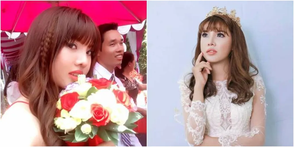 Merasa terhina dan kehilangan percaya diri, Kuok melakukan operasi plastik dan menemukan pendamping hidup kaya raya pada akhirnya © world of buzz