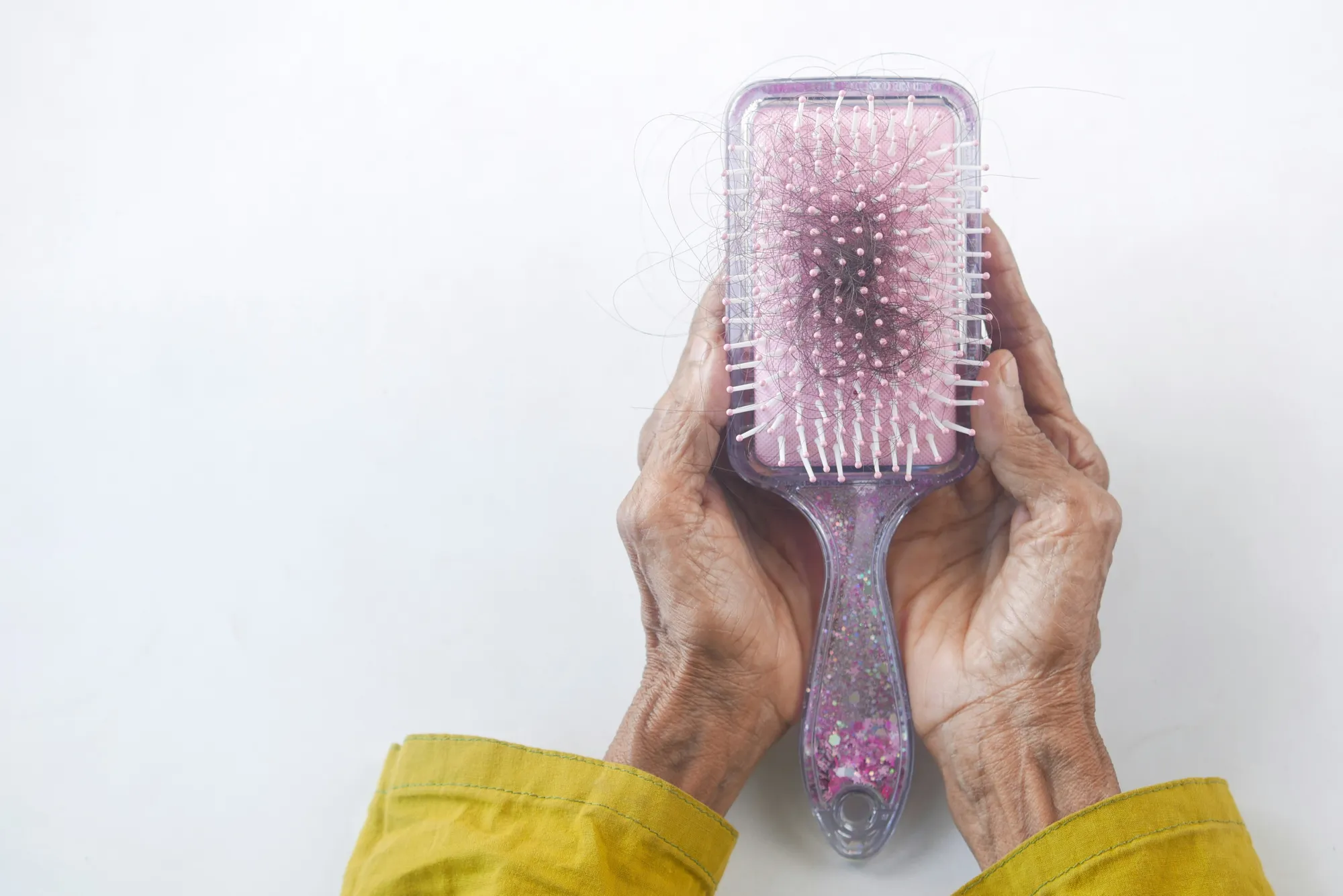 Ilustrasi Rambut Rontok/Photo by Towfiqu barbhuiya on Unsplash