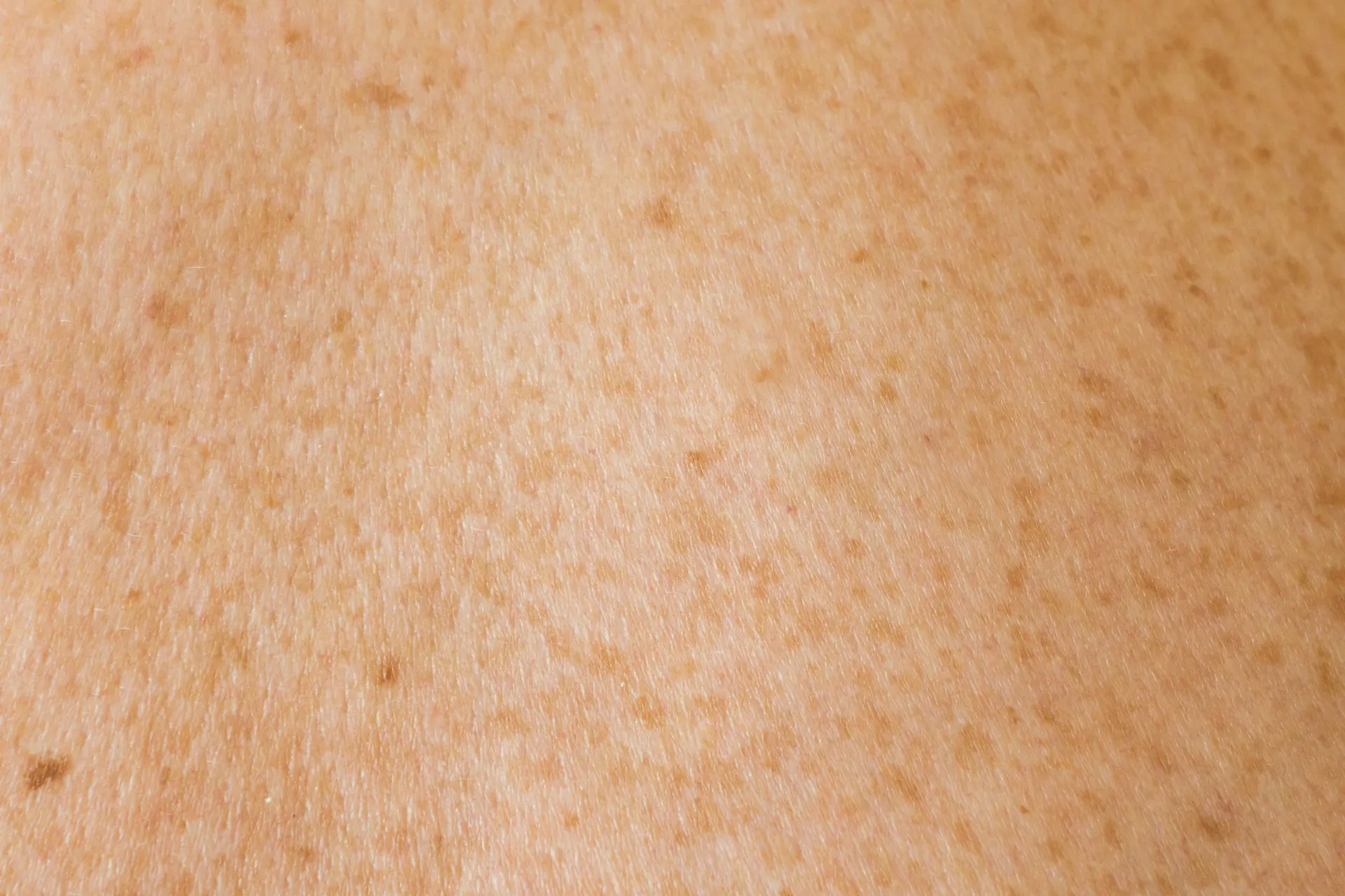 Close up kulit (credit: Unsplash)