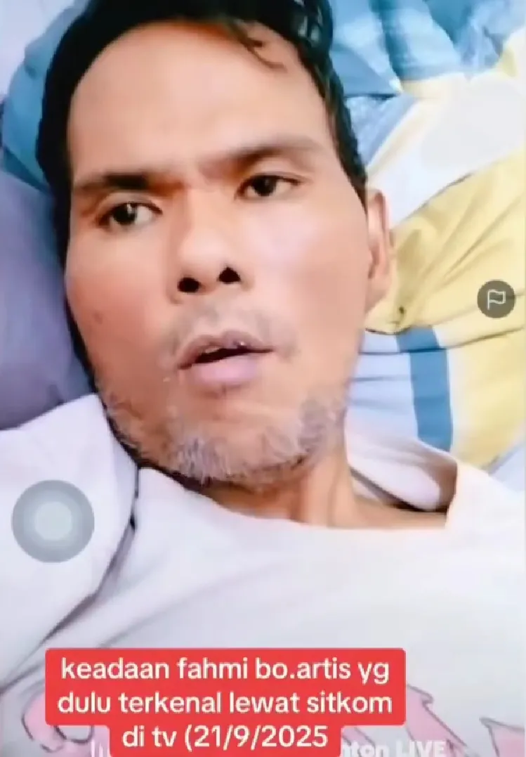 Kaki Bengkak Tak Bisa Digerakkan
