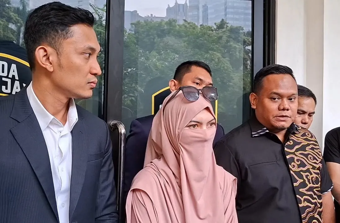 Wardatina Mawa pakai softlens © KapanLagi.com/Fikri Alfi Rosyadi