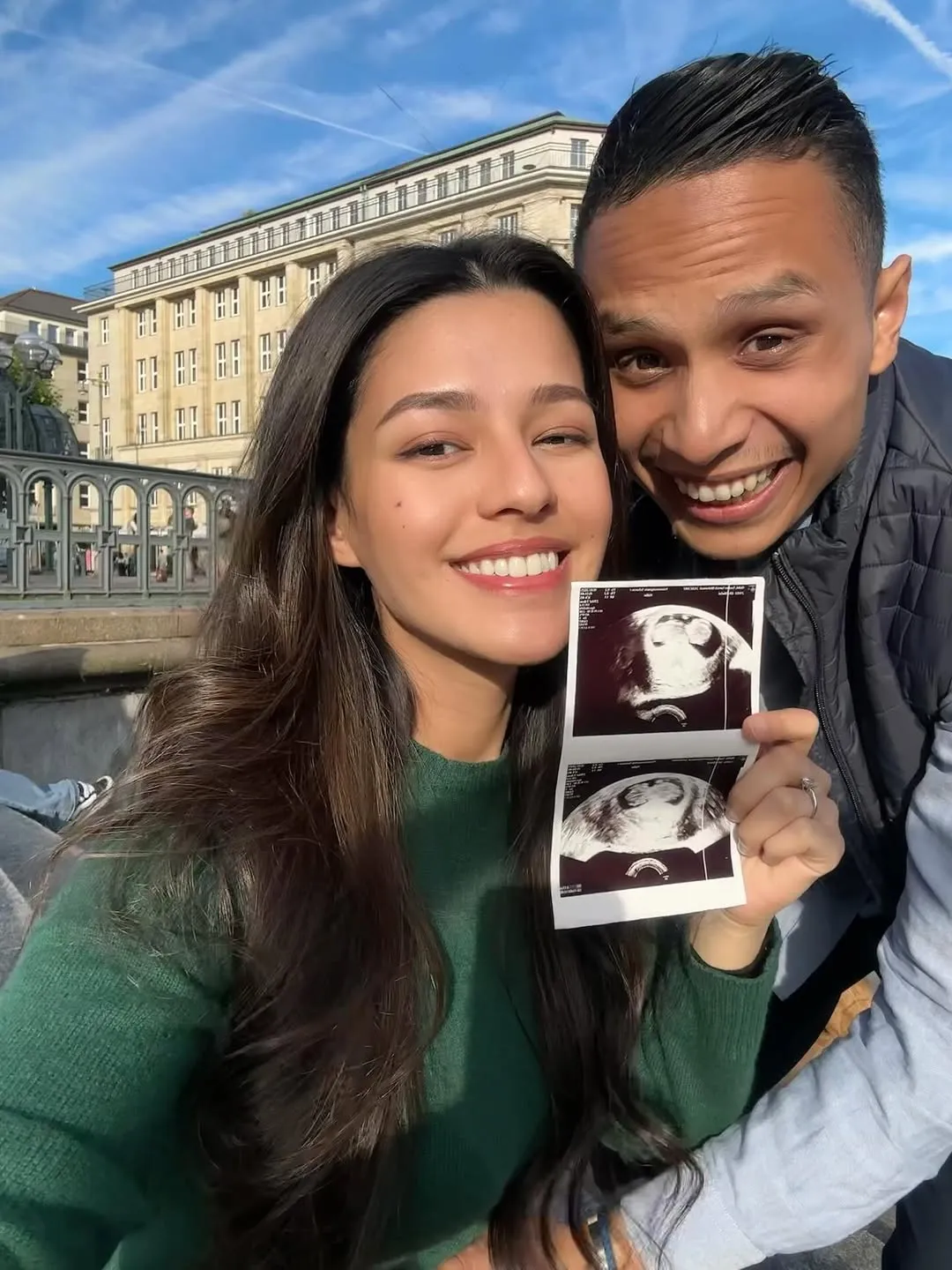 Susan Sameh Pamer Hasil USG (Cr:Instagram.com/susansameeh)