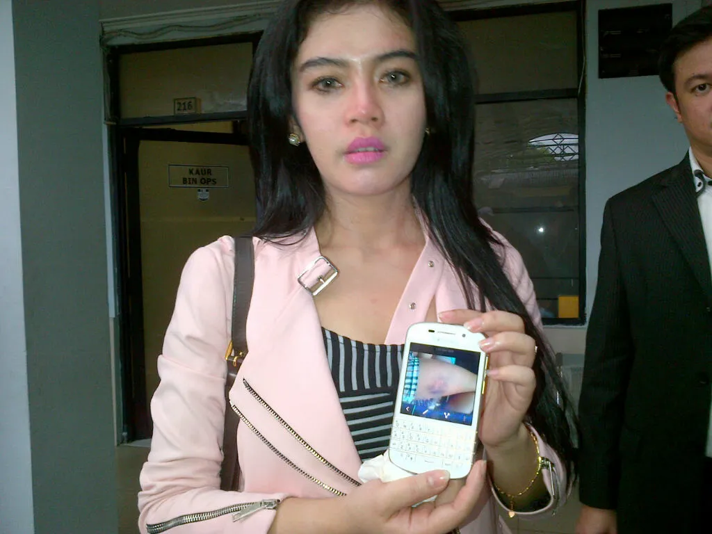 Intan mengaku dianiaya mantan kekasihnya. @KapanLagi.com®/Hendra Gunawan