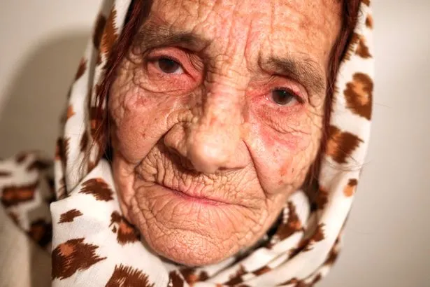 Hava Cebic, nenek yang mengaku dapat menyembuhkan berbagai penyakit mata dengan jilatan saja © mirror.co.uk