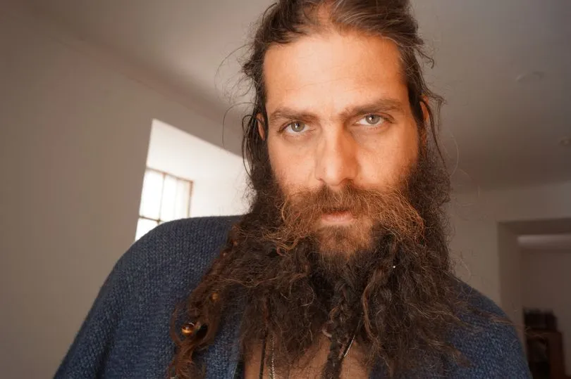 Mazzi Dumato, pengusaha kaya raya yang insyaf setelah alami kecelakaan hebat © mirror.co.uk