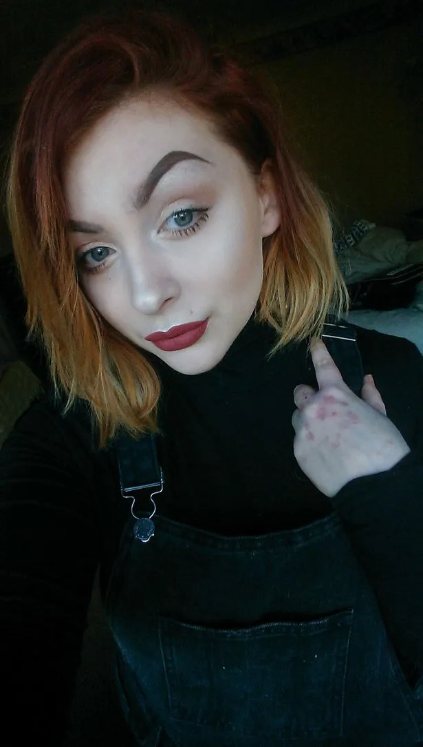 Kini dirinya berfokus ke bisnis make up dan tips bagi penderita psoriasis lainnya © mirror.co.uk