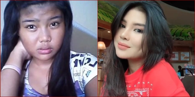 10 Astonishing Transformation Photos of Meldi, Dewi Perssik's Niece