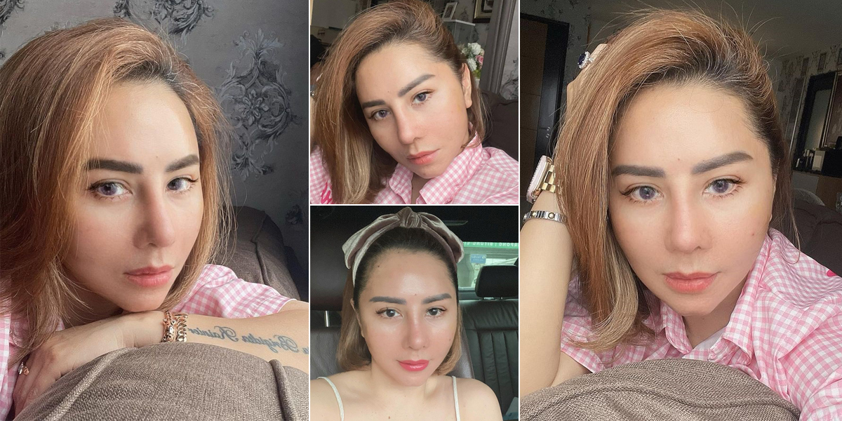 23 Days After Plastic Surgery in Korea, Femmy Permatasari Looks More Beautiful and Younger - Swelling and Bruises Have Reduced