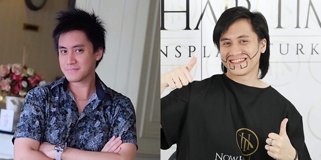 7 Moments Kevin Aprilio Hair Transplant, Lack of Confidence Because of Wide Forehead