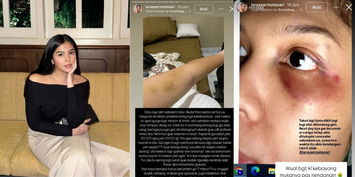 7 Photos of Influencer Laras Permatasari Experiencing Violence in Her Romantic Relationship