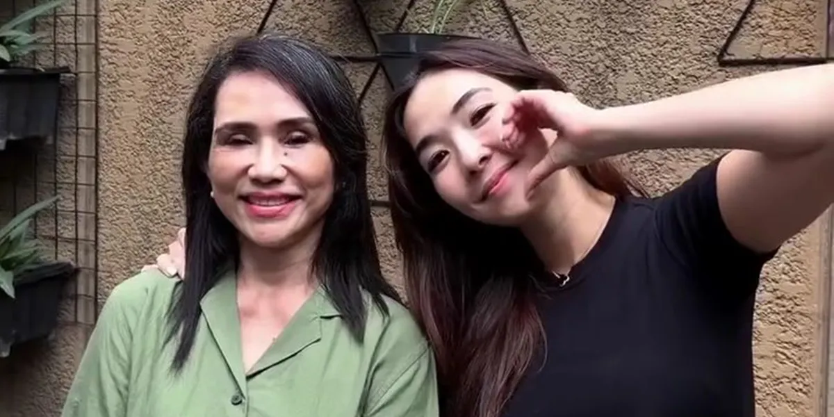  7 Potret Terbaru Ibu Gisella Anastasia Setahun Usai Facelift, Perubahannya Nyata 