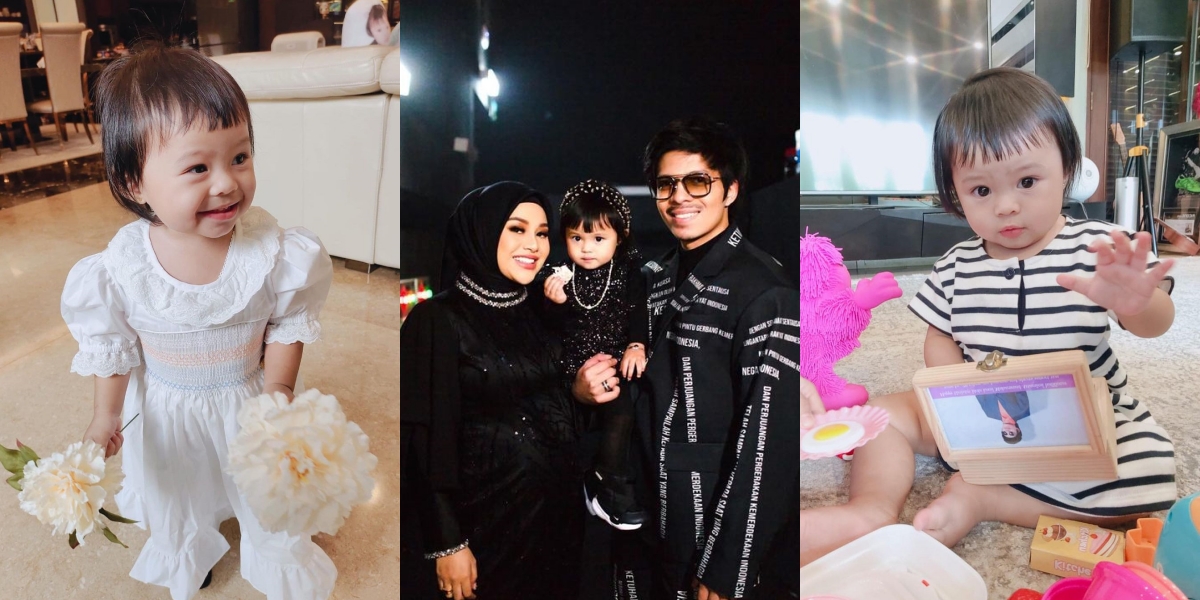 8 Adorable Photos of Ameena, Aurel Hermansyah's Daughter, Who Apparently Suffers from Eczema, Atta Halilintar Says It's Due to Genetic Factors - Must Avoid Certain Types of Food