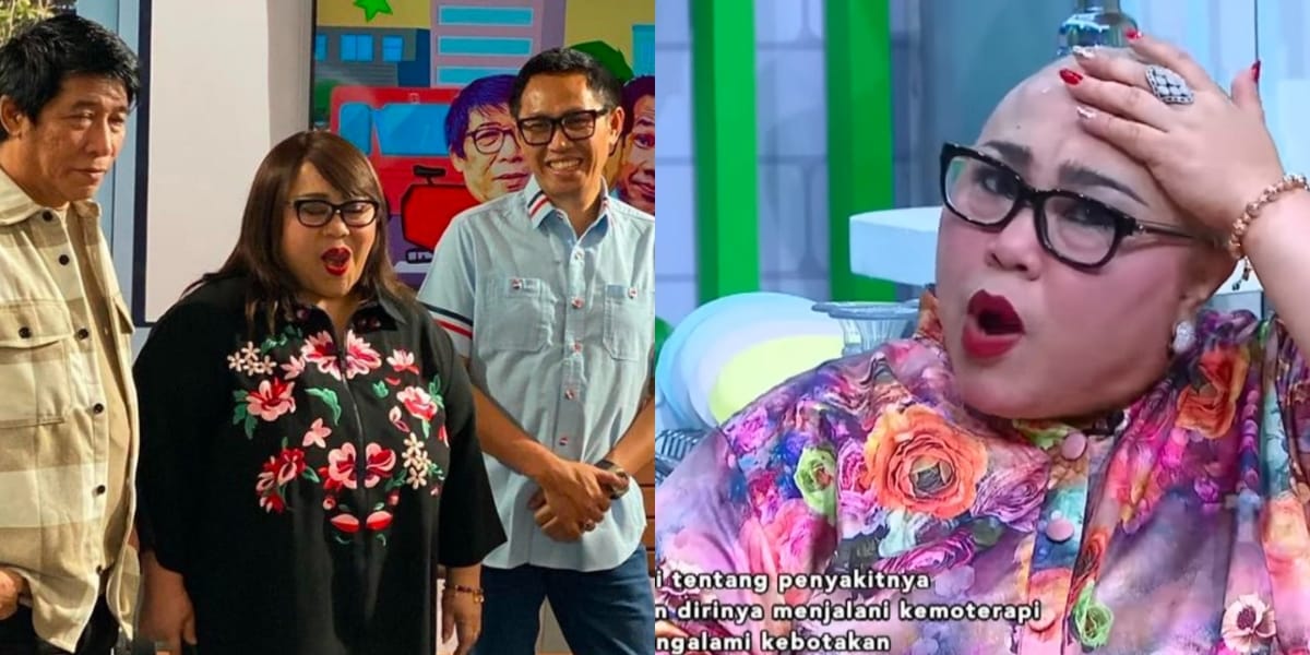 8 Photos of Comedian Nunung's Busy Life While Undergoing Chemotherapy, Willingly Being the Backbone of the Family