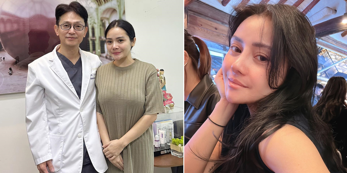 8 Photos of Mawar AFI's Nose Revision Surgery in Korea, Her New Nose is Praised as Beautiful & More Natural