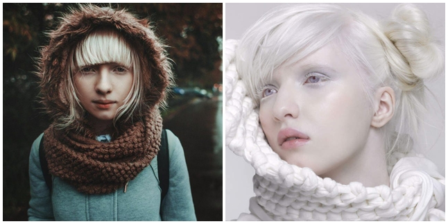 8 Photos of Nastya Zhidkova, Albino Model with Beautiful Eyes