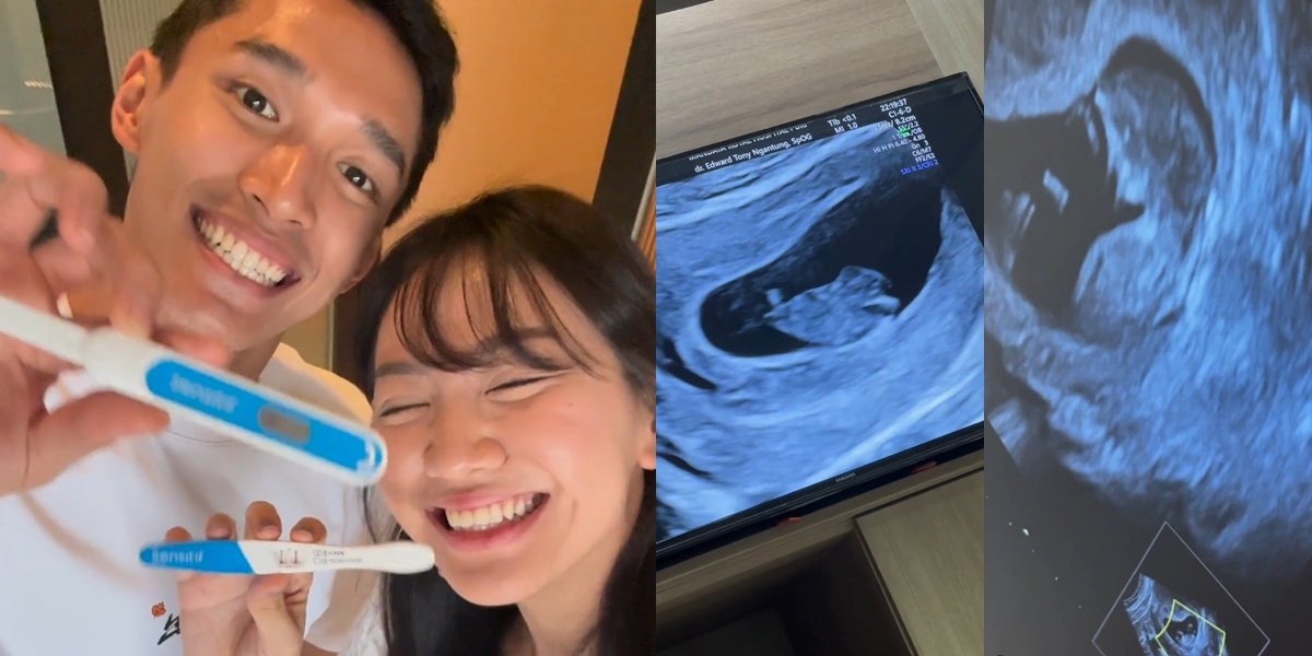 8 Photos of Shanju, Former JKT48 Member, Announcing First Pregnancy, Jonathan Christie Overjoyed