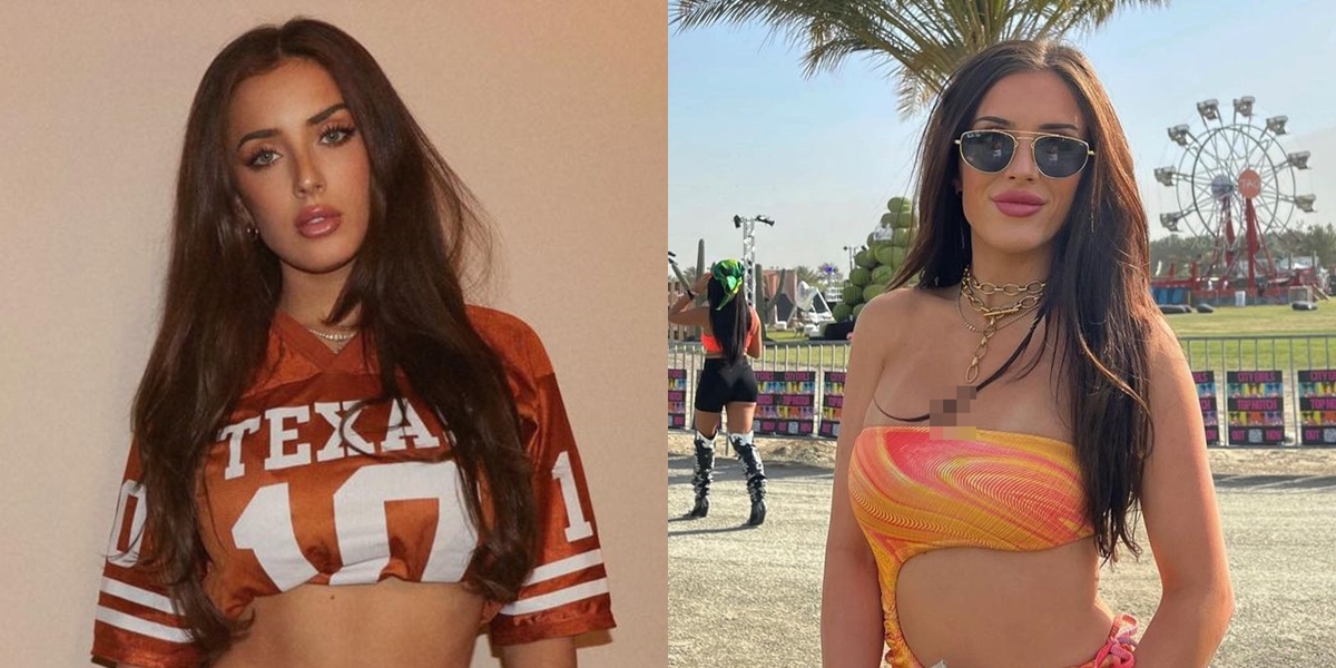 8 Photos of Sumner Stroh Model who Claims to be Adam Levine's Mistress for a Year, Said to be 50 Times Sexier than Her Photos - Criticized by Netizens
