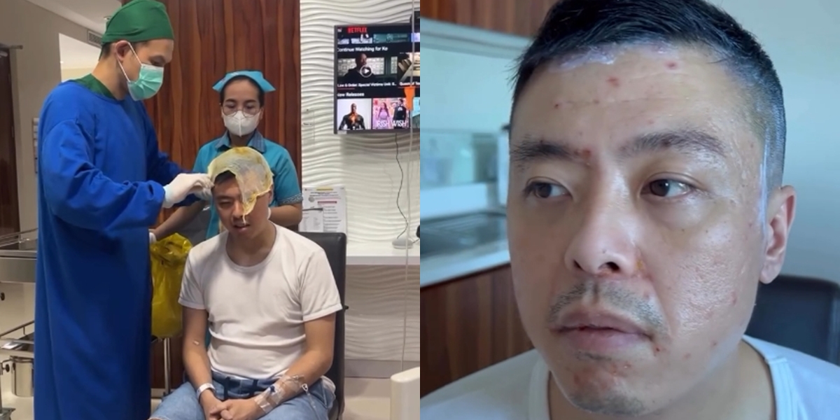 8 Photos of Vincent Raditya Getting Singapore Flu, Experienced High Fever and Body Aches Like Being Stabbed