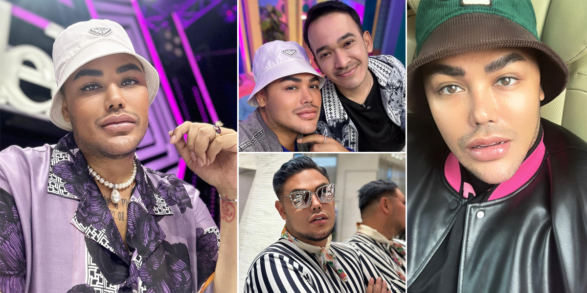 Ivan Gunawan's Lips Look Thicker in Latest Photo, Netizens are Distracted and Dislike it