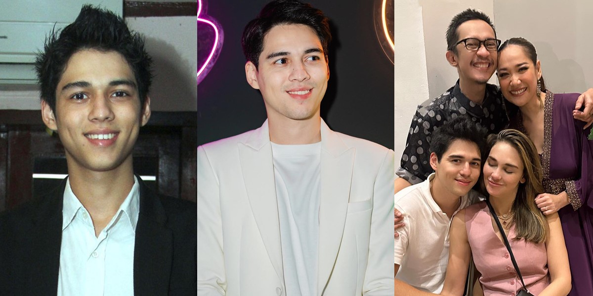 Suspected of Going Public with Luna Maya, 8 Photos of Maxime Bouttier's Transformation that Make Him Handsomer - His Dimpled Cheeks are Melting