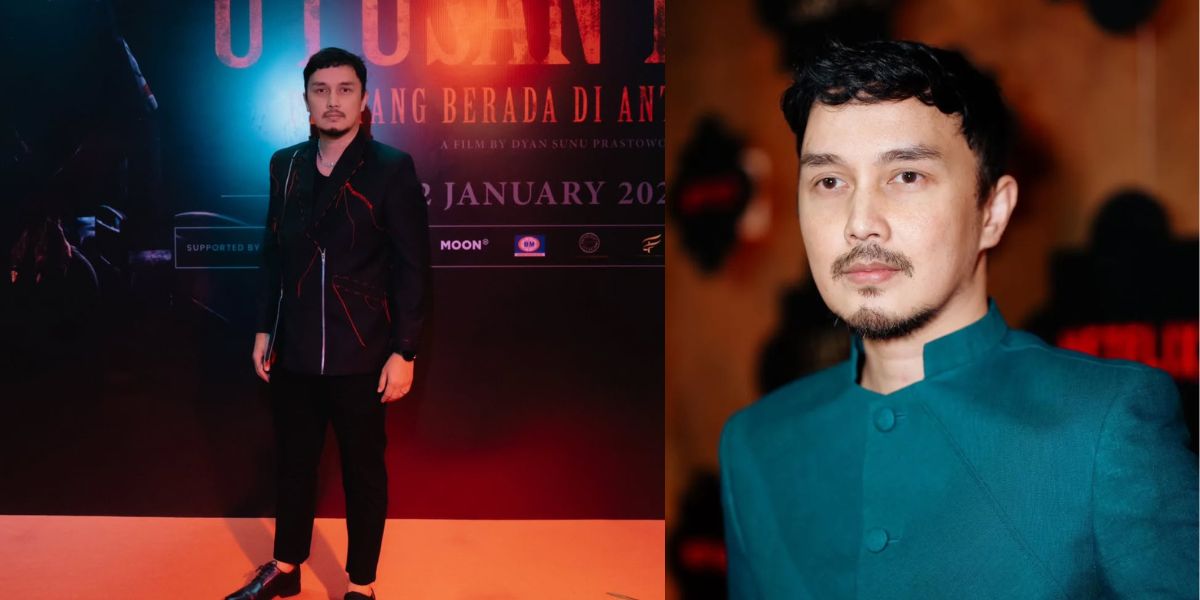 Dimas Aditya Shares Struggles Against Nerve Disease and Anxiety: Until Treatment in Malaysia