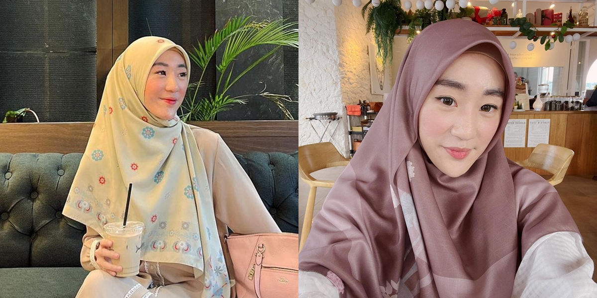 Called 'KI' Bidadari Sentul, 8 Portraits of Larissa Chou Allegedly Cheating Since 2019 - Alvin Faiz Says There Are Already 3 Men Claiming 