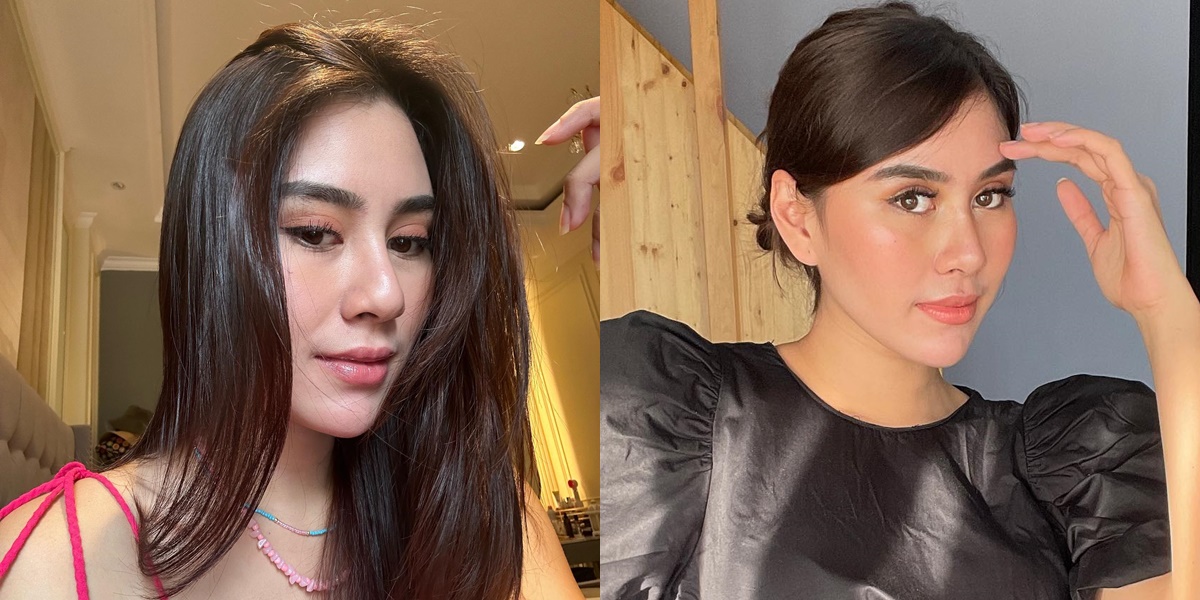 Accused of Having Plastic Surgery Because Her Face Looks Different, Here's a Portrait of Syahnaz Sadiqah's Transformation