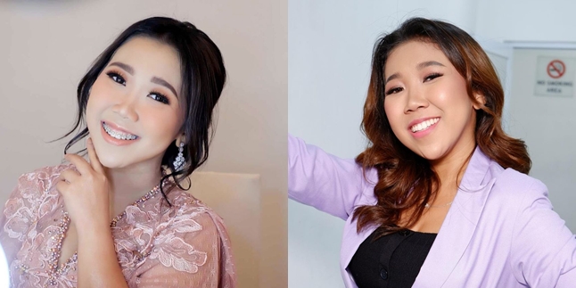 Formerly Paid 20 Thousand Rupiah Per Day, Here are 11 Portraits of Kiky Saputri who is Now More Glowing and Beautiful - Cheeks and Chin Become the Spotlight