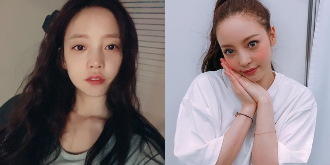 PHOTO: Admitting Eyelid Surgery, This is Goo Hara's Latest Appearance