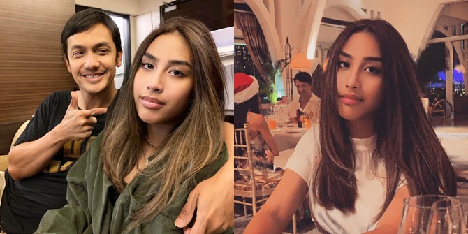 Foto Khayra Gunawan's Talented Singer Daughter, Once a Victim of Netizen Bullying