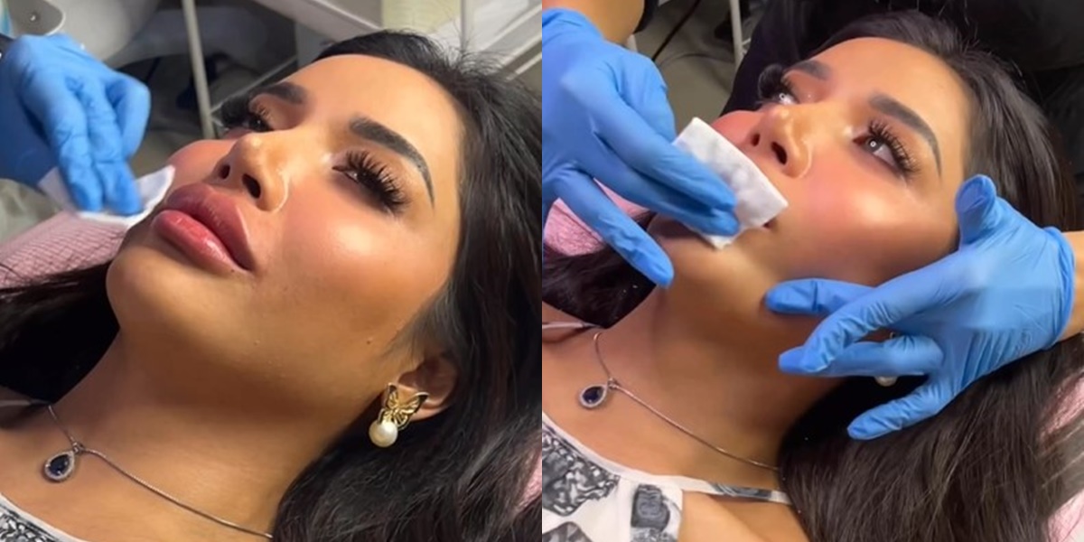 Millen Cyrus's Photo Doing Treatment and Willing to Inject Lips for Sexy Russian Lips