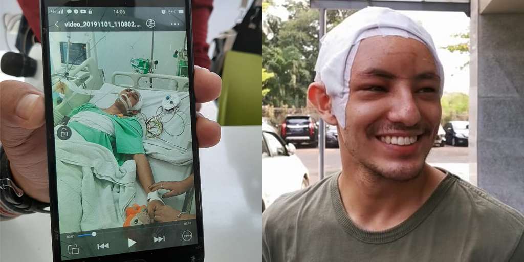 Latest Photo of Dylan Carr, Now Able to Smile Despite Head Bandages