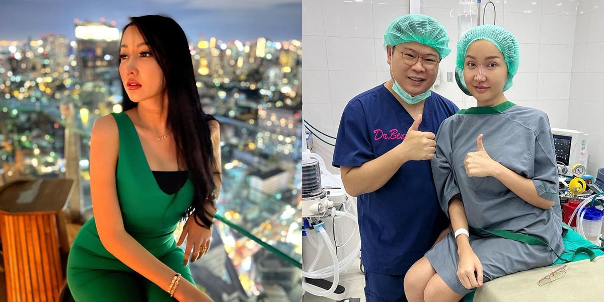 Undergo Plastic Surgery Again, Current Condition of Lucinta Luna Who is Criticized by Netizens - Upset That Her Nose is Compared to Pinocchio