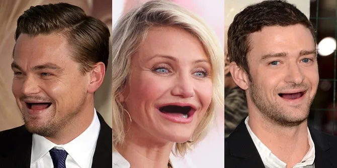 Kocak! Begini Jadinya Jika Artis Hollywood Tak Punya Gigi