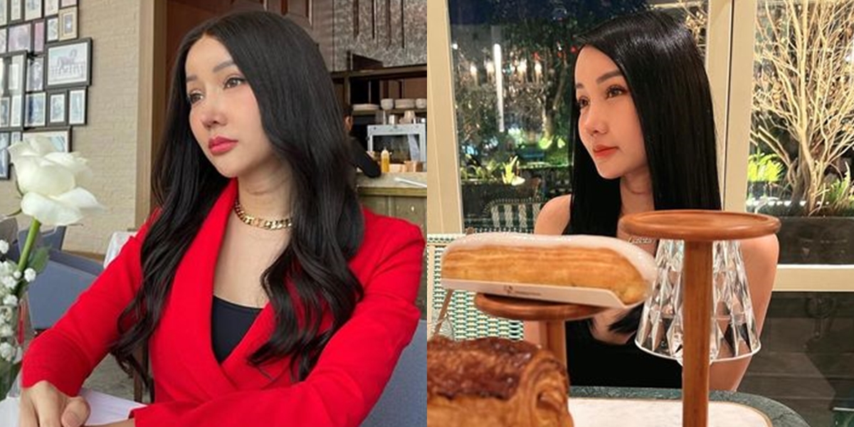 Collection of Photos of Lucinta Luna with Her New Face after Plastic Surgery, Calls Herself 'Angel of Heaven'