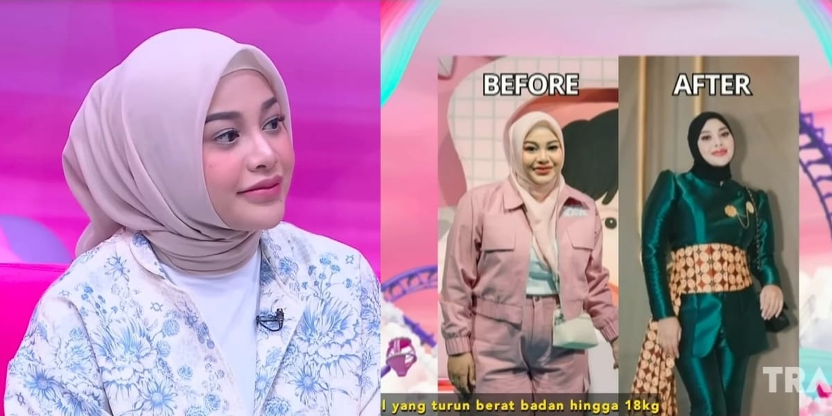 Aurel Hermansyah's Portrait Shares Her Struggle to Lose Weight Up to 21 Kg, Once Hospitalized