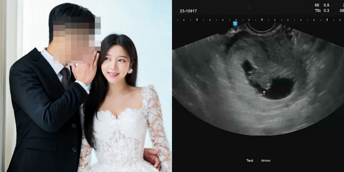 Portrait of Haein LABOUM Getting Married Today, Marrying a Friend - Last Month Already Announced Pregnancy