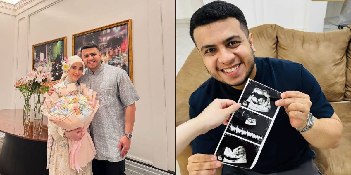 Portrait of Miskah Shafa, Fadil's Sister-in-Law, Announces Pregnancy with First Child, Yislam Asks for Good Prayers