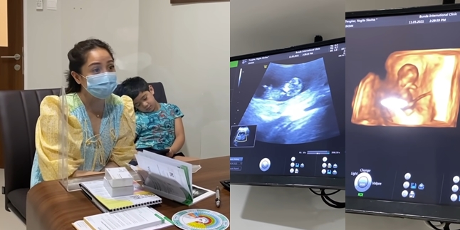 Portrait of Nagita Slavina Pregnancy Ultrasound, the Fetus is Allegedly a Boy - Examination without Raffi's Company