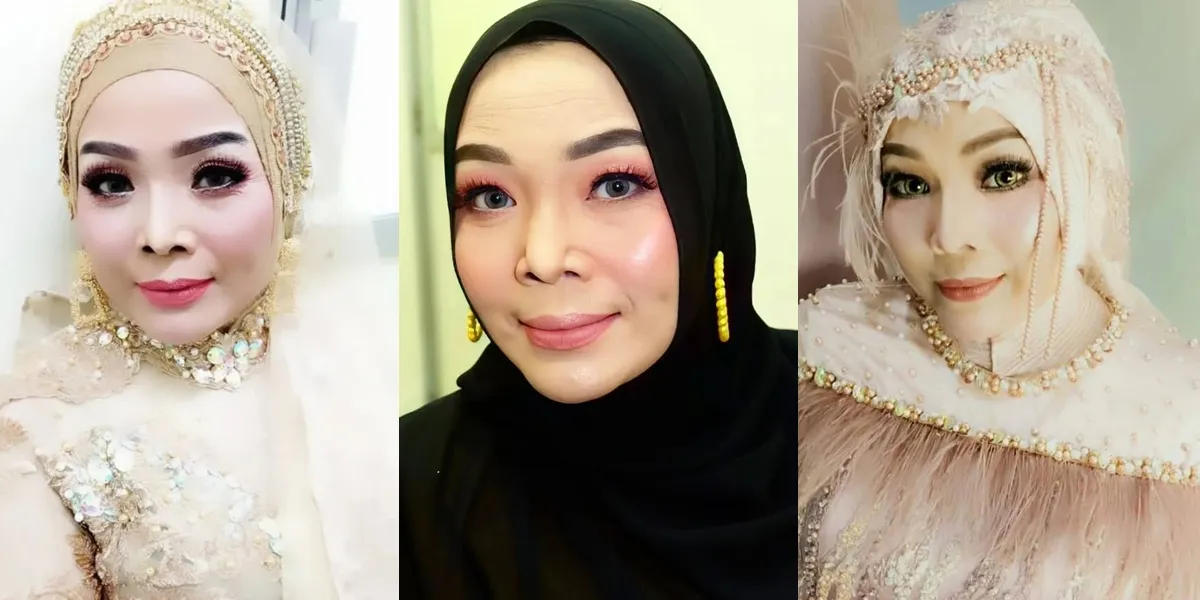 Portrait of Yunita Ababiel Fighting Cancer, Son Reveals Mother's Final Condition