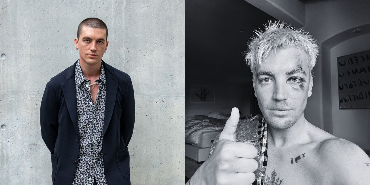 8 Portraits of LANY Vocalist, Paul Klein Experiences Accident Until Reschedule Concert Schedule