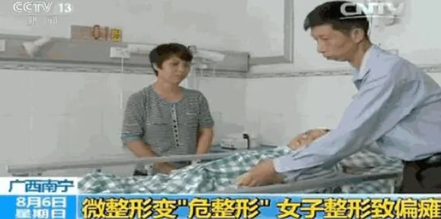 Seorang wanita asal China jatuh koma setelah melakonii prosedur sedot lemak yang salah © Shanghaiist.com
