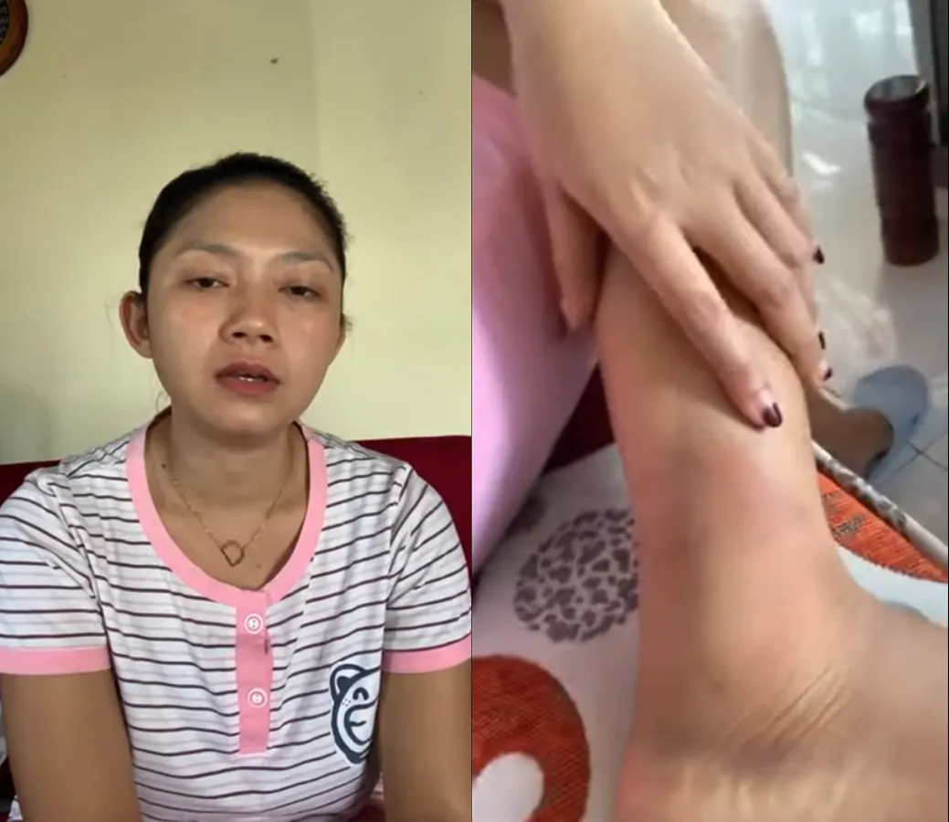 Kondisi terbaru Ratna Antika Saat Ini