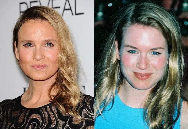 Renee Zellweger sekarang dan dulu @ dailymail.co.uk