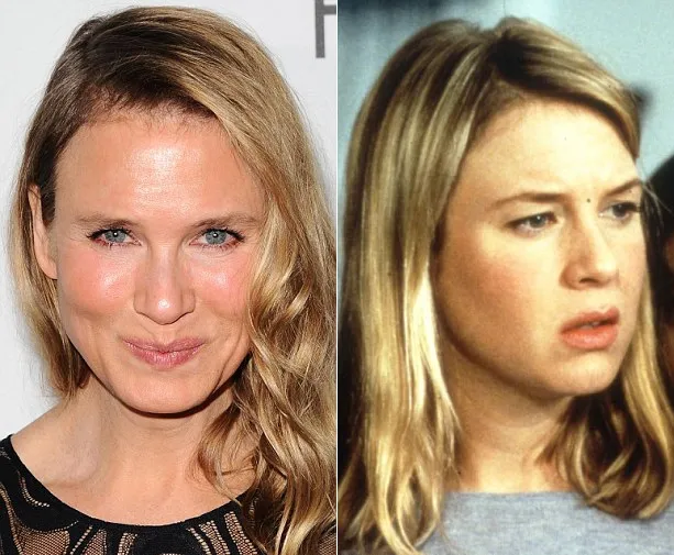 Renee seminggu lalu dan Renee dulu @ dailymail.co.uk