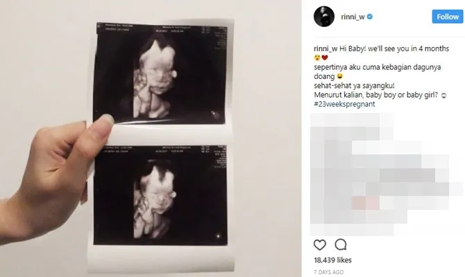 Rinni menunjukkan hasil USGnya, dari foto ini sudah keliatan belum mirip siapa kelak? © Instagram/rinni_w