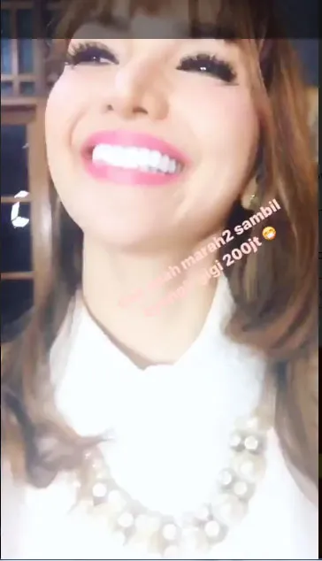 Seperti ini penampakan gigi veneer Roro Fitria. © Instagram/roro.fitria1989
